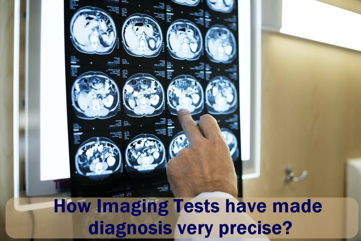 How Imaging Tests have made diagnosis very precise